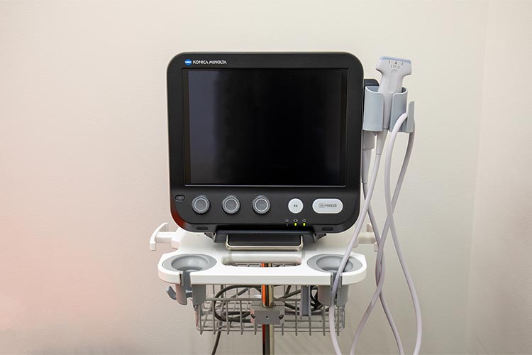 超音波検査装置（エコー）